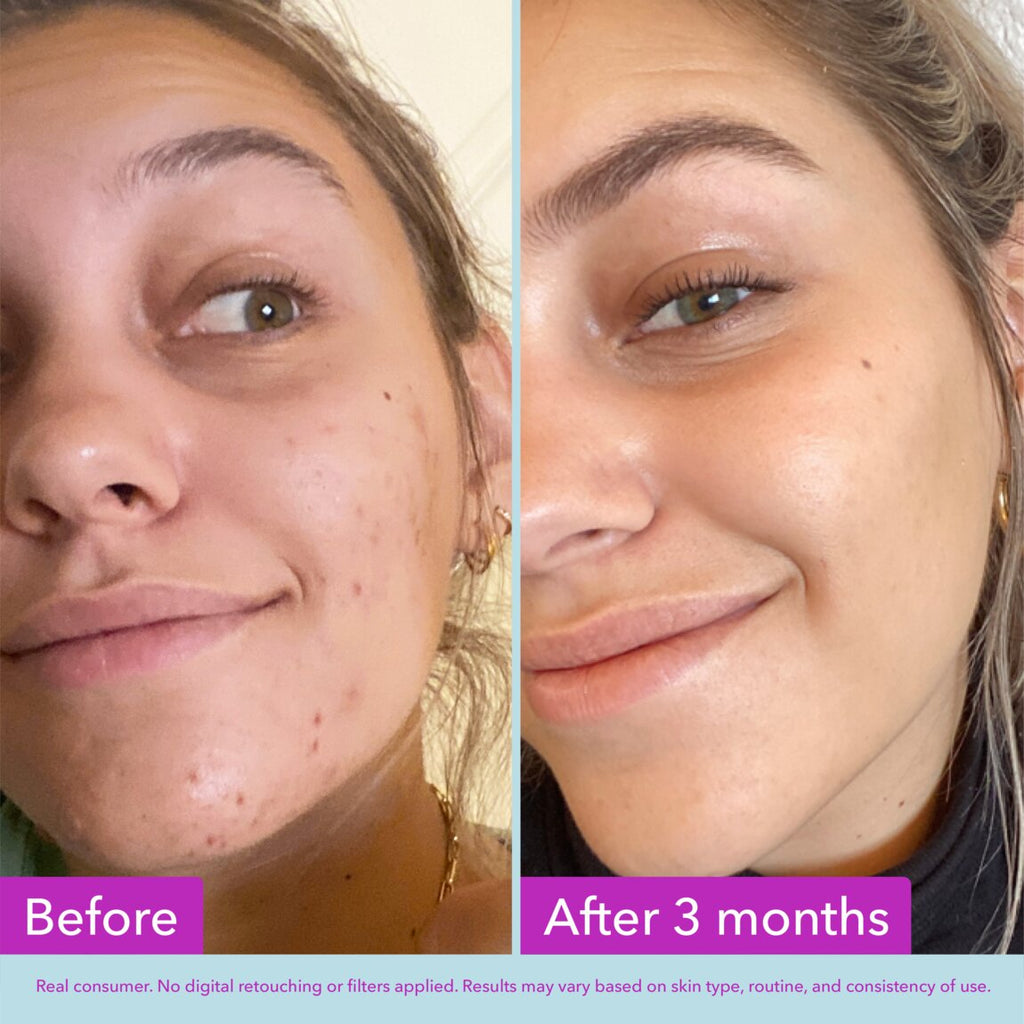 Good Molecules Niacinamide Brightening Toner 120ml alternative view 3.